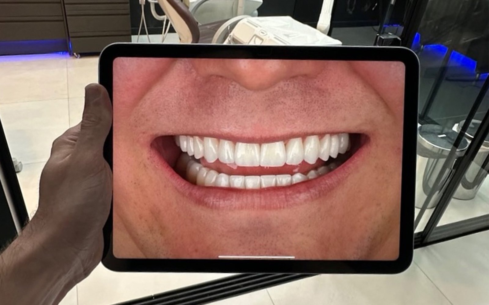 Visualização do sorriso real em tela digital